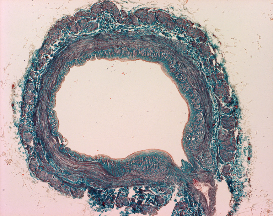 Mephisto Histologische Praparate Gefasssystem Vene