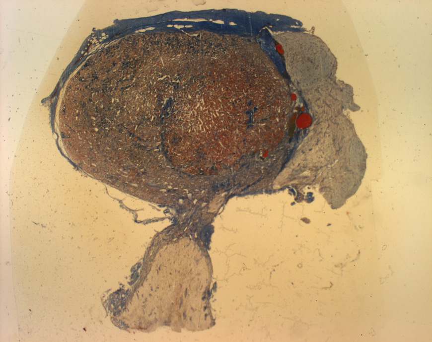 mephisto Histologische Präparate Testat 3 Hypophyse